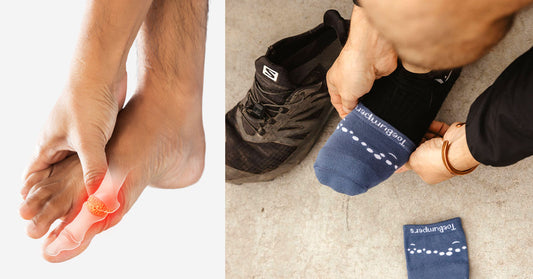 Struggling with Big Toe Joint Pain? Discover the Best Toe Socks and Running Socks for Relief!