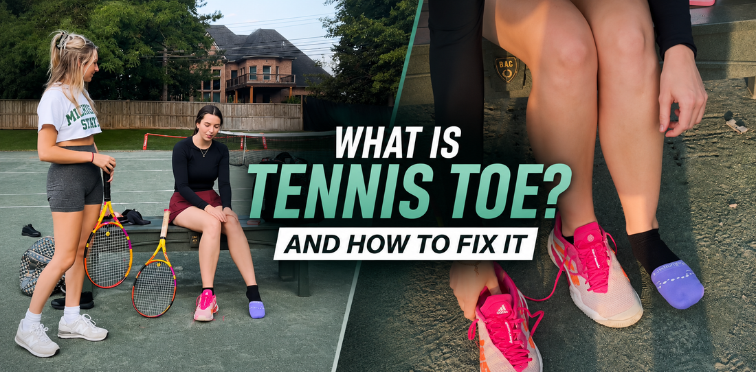 What Is Tennis Toe — And How Do You Stop It?